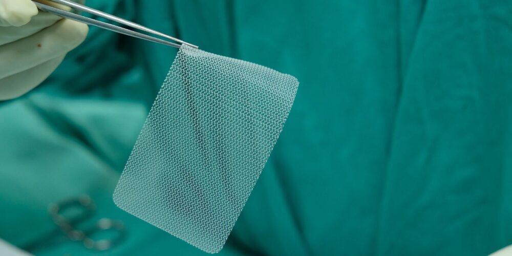 Surgeon holding hernia mesh with surgical tweezers