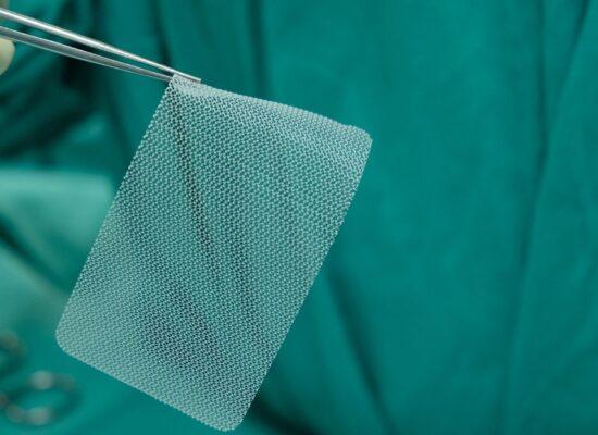 Surgeon holding hernia mesh with surgical tweezers